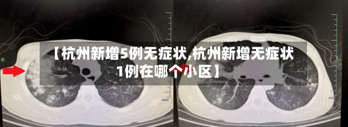 【杭州新增5例无症状,杭州新增无症状1例在哪个小区】