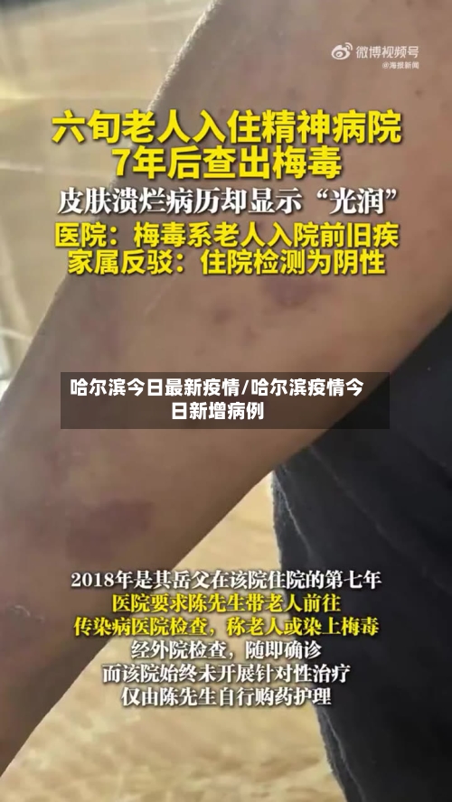 哈尔滨今日最新疫情/哈尔滨疫情今日新增病例