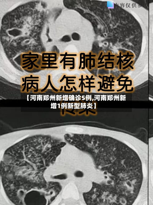 【河南郑州新增确诊5例,河南郑州新增1例新型肺炎】-第2张图片