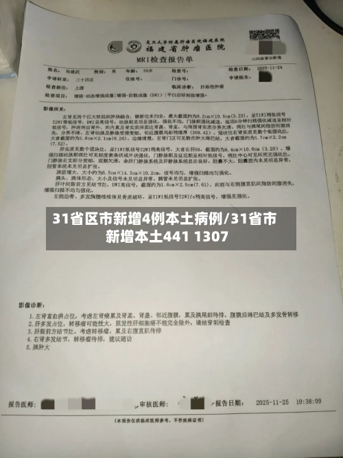 31省区市新增4例本土病例/31省市新增本土441 1307