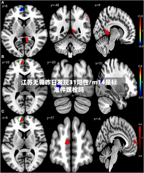 江苏无锡昨日发现31阳性/m14是标准件螺栓吗
