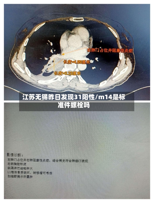 江苏无锡昨日发现31阳性/m14是标准件螺栓吗-第3张图片