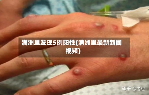 满洲里发现5例阳性(满洲里最新新闻视频)