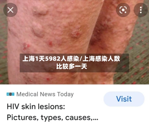 上海1天5982人感染/上海感染人数比较多一天-第3张图片