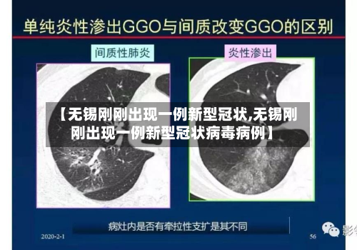 【无锡刚刚出现一例新型冠状,无锡刚刚出现一例新型冠状病毒病例】-第3张图片