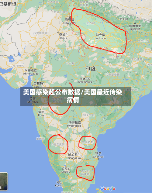 美国感染超公布数据/美国最近传染病情
